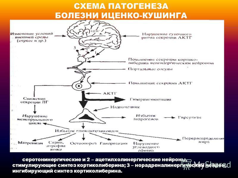 Схема этиологии и патогенеза болезни иценко кушинга