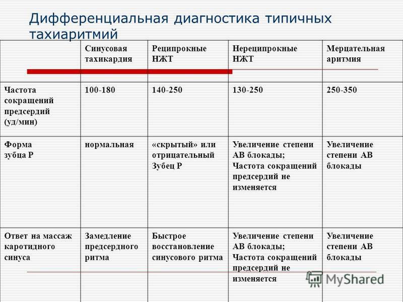 Диагностика тахиаритмии