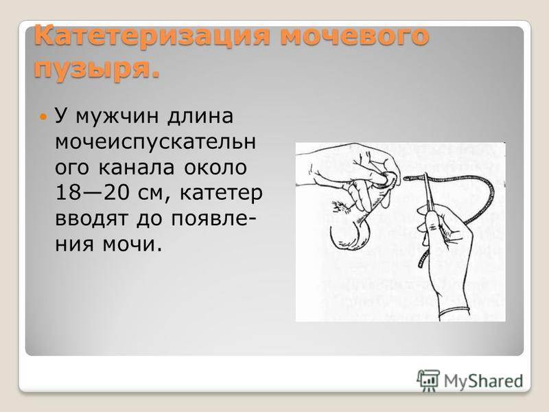 Уход за постоянным мочевым катетером фото