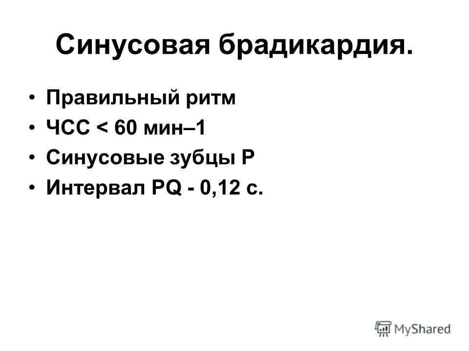 Брадикардия мкб. Синусовая брадикардия ЧСС 52. Синусовая брадикардия с ЧСС 58. Синусовая брадикардия мкб 10. Синусовая брадикардия мкб 10 у взрослых.