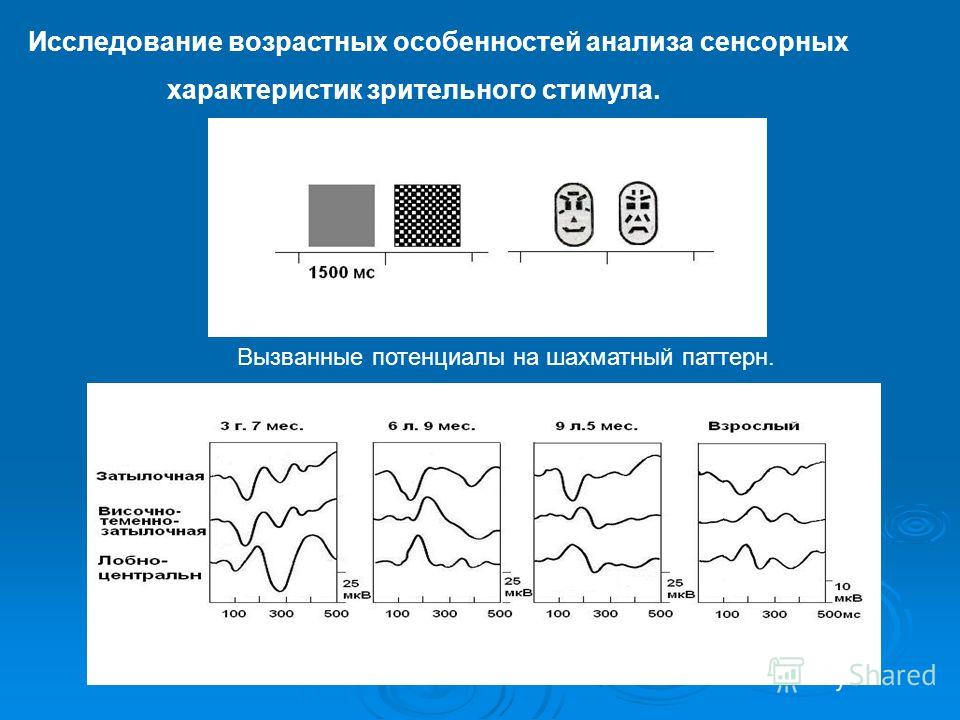 Зрительные вызванные потенциалы