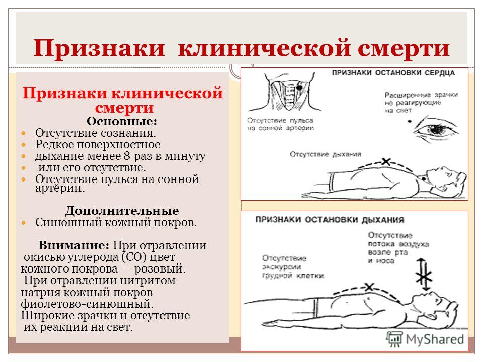 Признаки умершего. Первая помощь при клинической смерти и биологической смерти. Клиническая смерть симптомы и первая помощь. Критерии клинической смерти. Проявления клинической и биологической смерти.