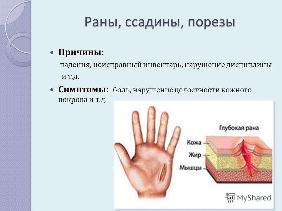 Нарушение кожных покровов и повреждение кожи презентация. Резаные раны поверхностные.