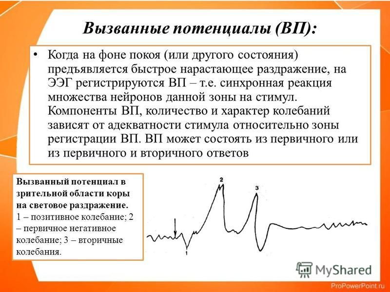 Зрительные вызванные потенциалы