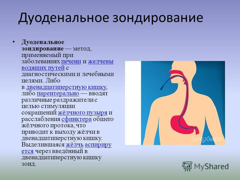 Дуоденальное зондирование картинки