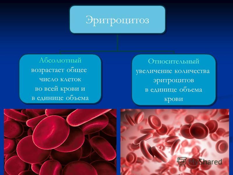 Эритроцитопения. Эритроцитоз и эритроцитопения. Эритроцитоз и эритремия. Полицитемия эритроцитов. Относительный эритроцитоз.