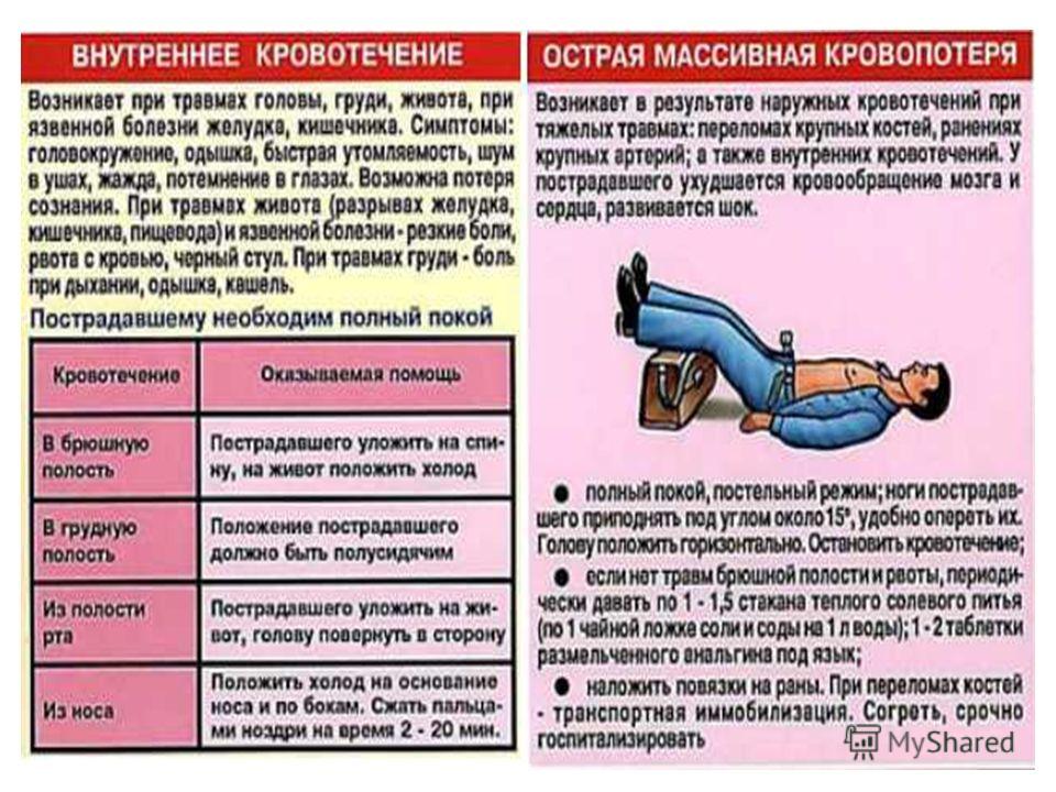 Можно ли при кровотечении. Симптомы внутреннего кровотечения. Внутреннее кровотечение признаки и первая помощь. Симптомы при внутреннем кровотечении. Внутреннее кровотечение возникает при.