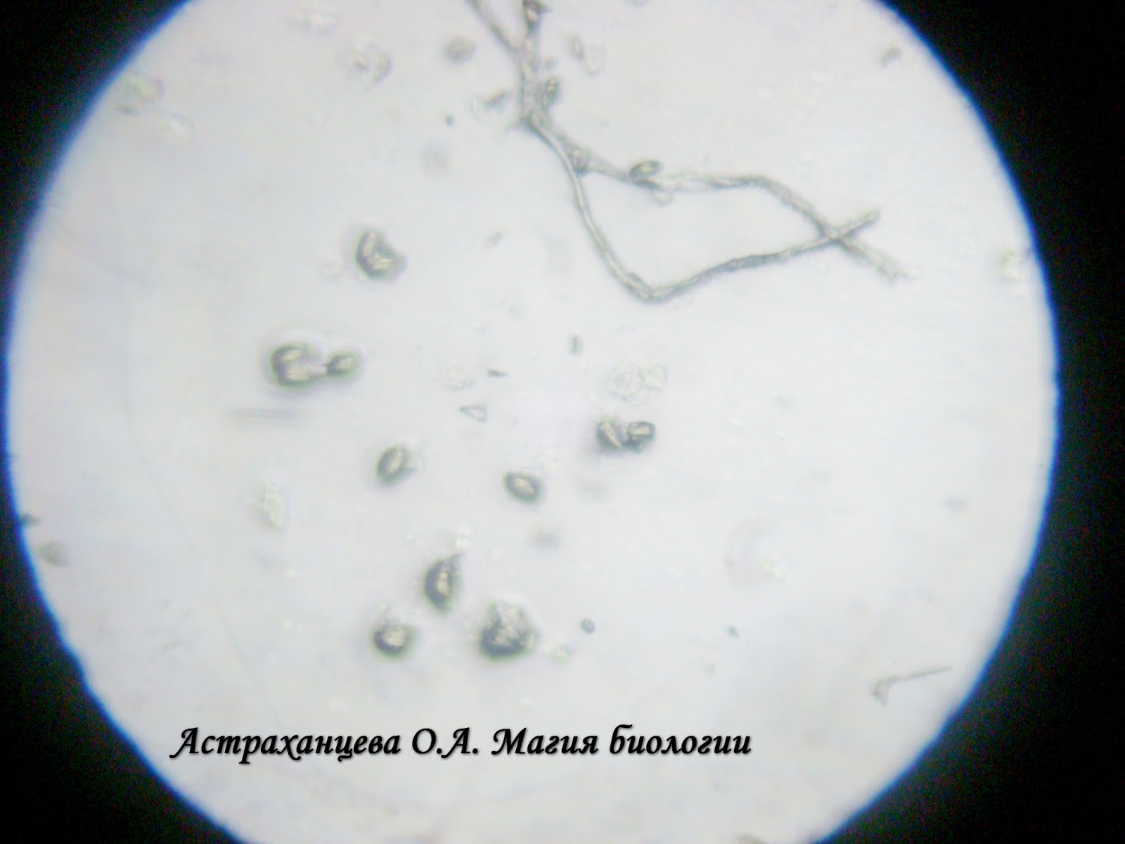 Слизь единичные. Мокрота под микроскопом в нативном препарате. Слизь в моче под микроскопом. Эластические волокна в мокроте под микроскопом. Мокрота под микроскопом под микроскопом под микроскопом.