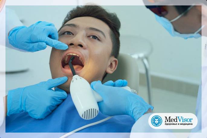 Сохнет рот причины у пожилых людей. Химиотерапия полости рта. Сухой рот стоматология. Сухость при лечении зубов.