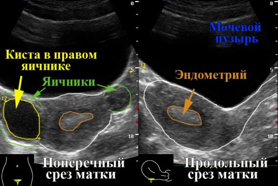 Патологии женской половой системы