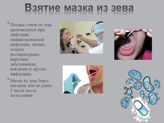 Взятие мазка из зева