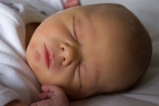 Picture of newborn baby with yellow skin.