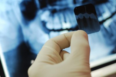 рентгенография зубов
