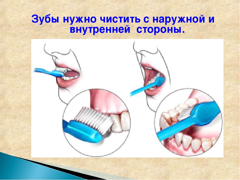 Этапы гигиены полости рта. Чистка зубов тяжелобольному. Чистка зубов тяжелобольному пациенту. Гигиена полости рта тяжелобольного пациента. Уход за полостью рта,чистка зубов.алгоритм.