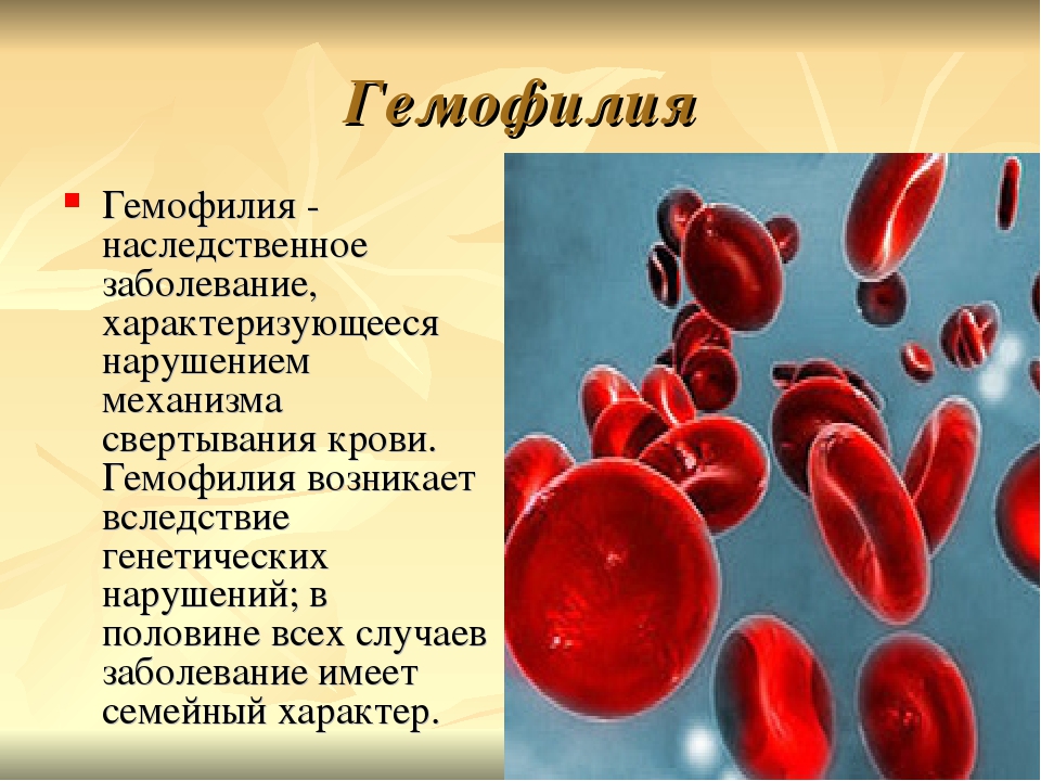 Наследственные болезни характеризуются. Гемофилия 8 класс биология. Наследственные заболевания по биологии. Презентация на тему наследственные заболевания.