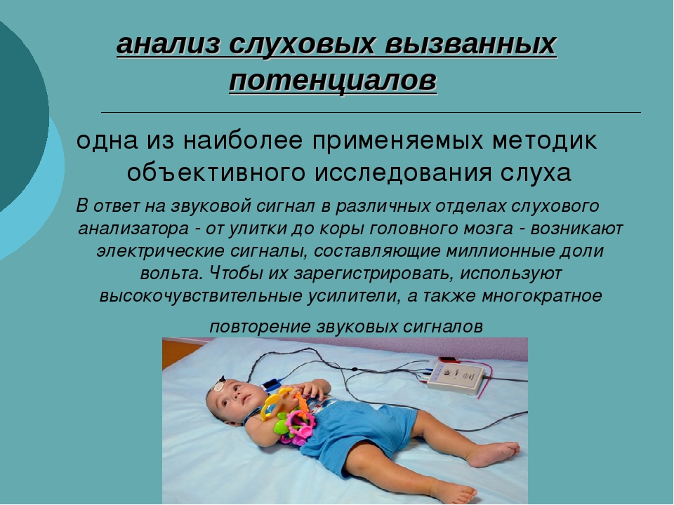 Вызови слух. Слуховые вызванные потенциалы. Вызванные слуховые потенциалы обследование что это. Метод слуховых вызванных потенциалов. Методика слуховых вызванных потенциалов.