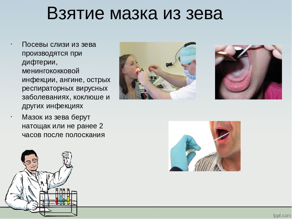 Посев полости рта. Алгоритм взятие из Зевы мазка зева. Мазок из зева и носа исследование. Мазок из зева и носа на BL. Исследование мазка из носа и зева на дифтерию.