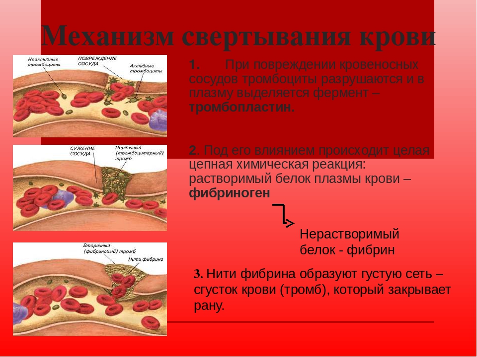 Основной тромб. Тромбоциты механизм свертывания крови. Образование тромба механизм тромбоцитов. Тромбоциты свертывание крови. Тромбоциты процесс свертывания крови.