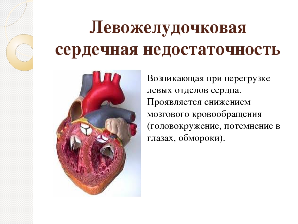 Острая сердечная недостаточность возникает. Острая левожелудочковая сердечная недостаточность проявляется. Симптомы острой левожелудочковой сердечной недостаточности. Левожелудочковая недостаточность острая коронарная недостаточность. Острая левая желудочковая недостаточность.