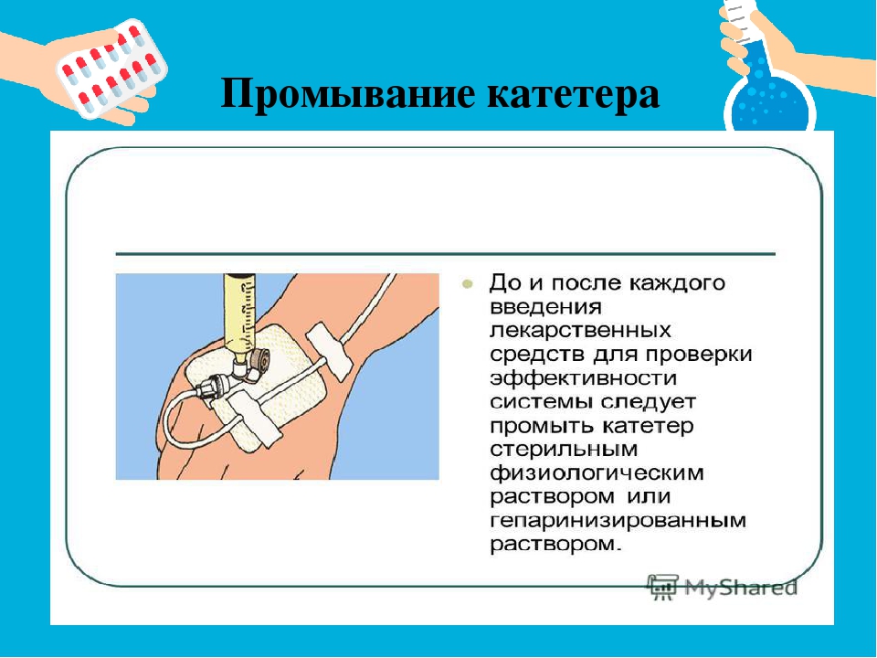 Нужно промыть. Промывание венозного катетера. Как промывать периферический катетер.