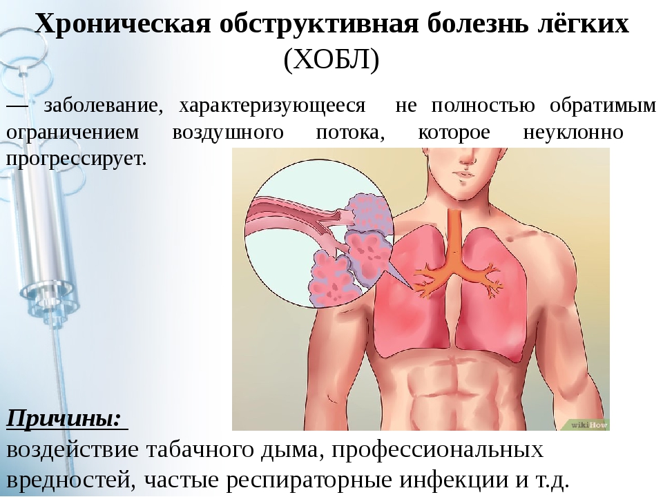 Хроническая обструктивная болезнь легких картинки