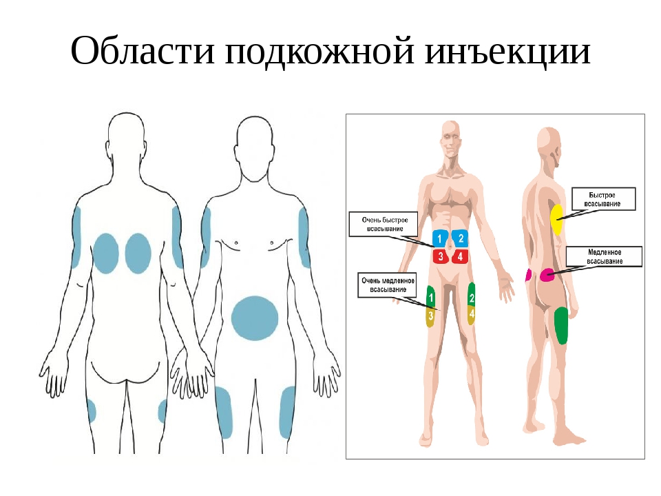 Где делают человек. Подкожное Введение лекарственного препарата (2d-тренажер). Подкожная инъекция места введения лекарственных. Анатомические области для подкожной инъекции. Анатомическая область для подкожного введения лекарственных средств.