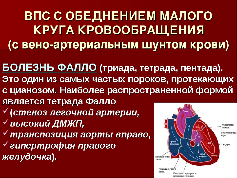 Какие пороки сердца. Врожденный порок сердца с обеднением малого круга кровообращения. Врожденные пороки сердца гемодинамика. Врожденные пороки сердца у детей.