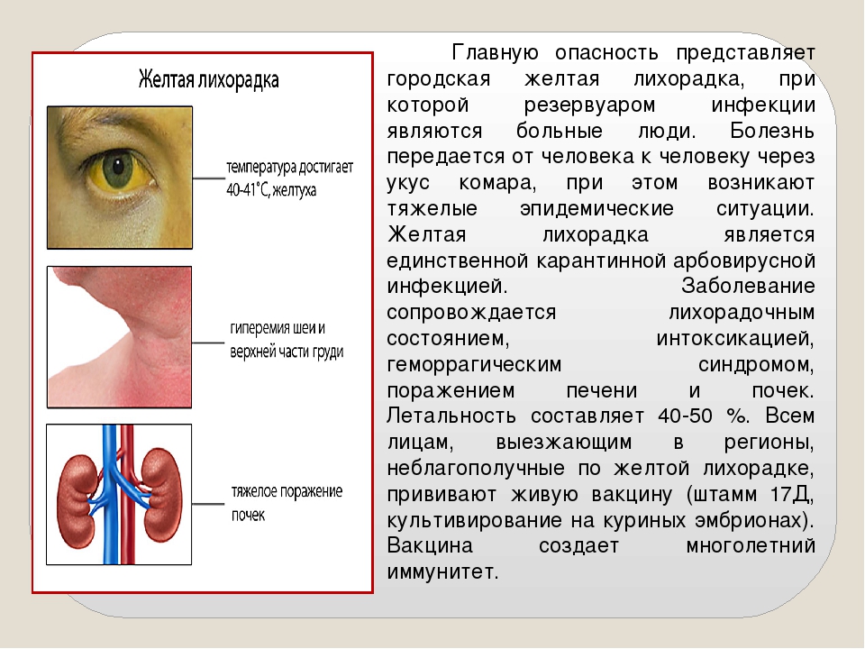 Период желтой лихорадки