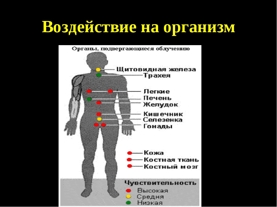 Влияние тела. Воздействие радиации на организм человека. Влияние радиоактивного излучения на организм человека. Влияние излучения на организм человека.