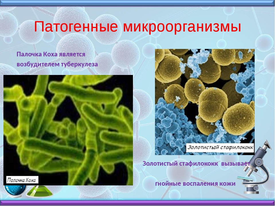 Приведите три примера бактерии