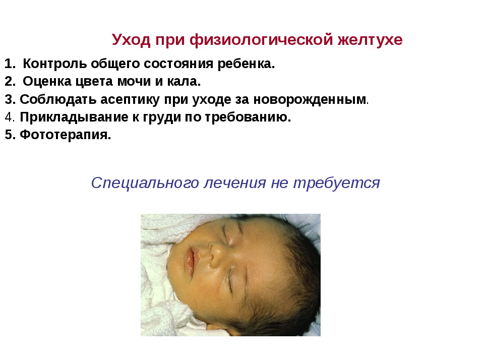 Физиологическая желтуха у новорожденных сколько. Транзиторные состояния новорожденных желтуха. Тактика при желтухе у новорожденных. Рекомендации по уходу за ребенком при физиологической желтухи. Физиологическая желтуха сестринский уход.