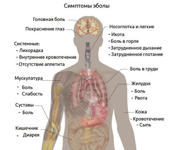 Где находится легкие у человека фото и как болит