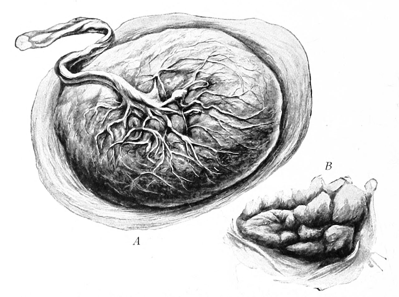Пуповина строение. Эмбрион плацента пуповина. Плацента и пуповина анатомия.