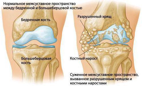 синовиальная оболочка тазобедренного сустава