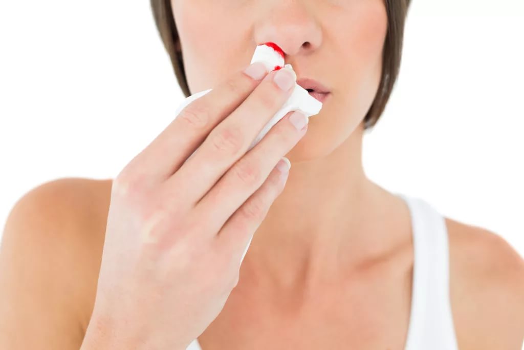 Носовые кровотечения - симптом болезни