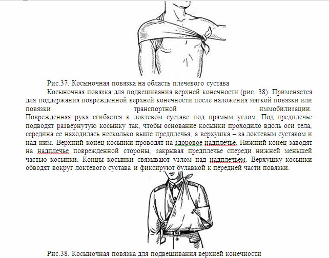 Плечевая повязка алгоритм. Перелом ключицы Косыночная повязка. Техника наложения косыночной повязки на плечевой сустав. Наложение косыночной повязки на плечо и плечевой сустав. Косыночная повязка на плечевой сустав алгоритм.