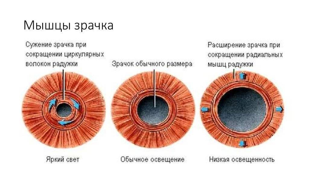 Как выглядит искусственный хрусталик для глаза фото