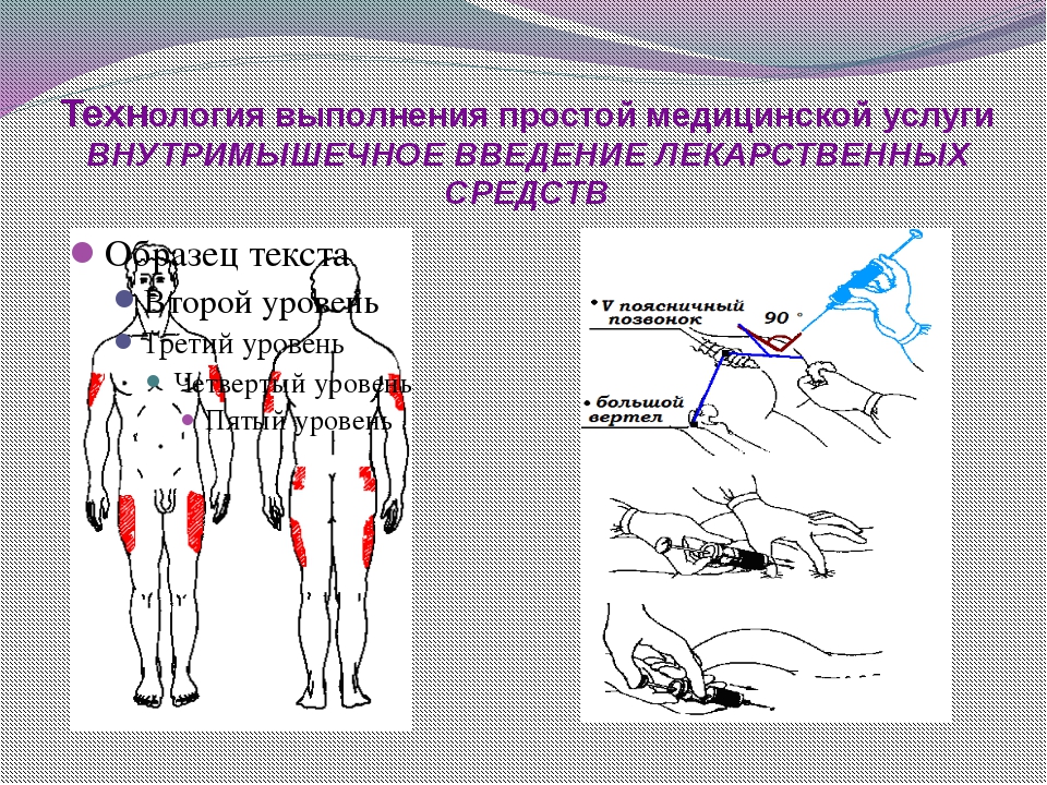 Картинки в м инъекции