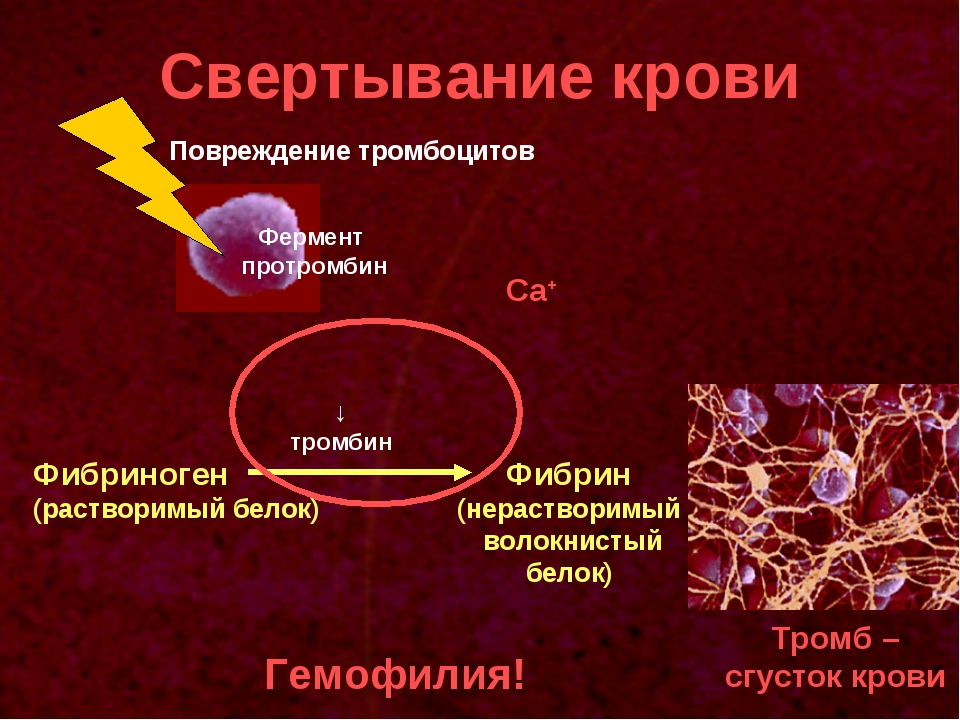 Заболевание свертывания крови. Протромбин тромбопластин тромбин фибриноген фибрин тромб. Механизм свертываемости крови 8 класс. Схема свертывания крови образование сгустка. Тромбин крови.