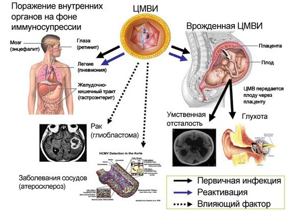 TORCH-инфекции (ТОРЧ-инфекции). Что это такое, анализ крови при планировании беременности, расшифровка