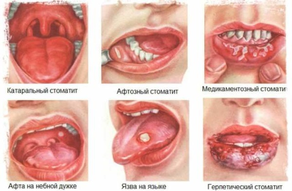 Желудочно-кишечный тракт (ЖКТ) человека. Анатомия, строение, заболевания, симптомы, лечение