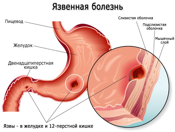 Желудочно-кишечный тракт (ЖКТ) человека. Анатомия, строение, заболевания, симптомы, лечение