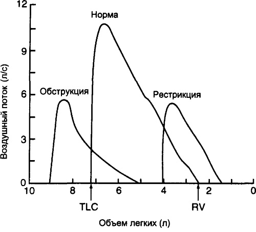 Рестрикция дыхательных путей. Что это такое, спирография, причины и лечение