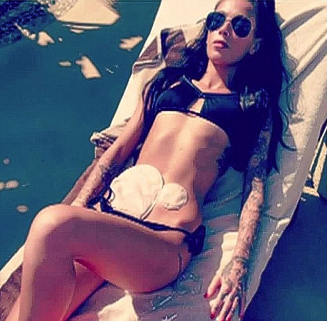 Bethany Townsend became an internet sensation by posting a photograph of herself in a bikini, exposing the colostomy bags she has to wear because of Crohn
