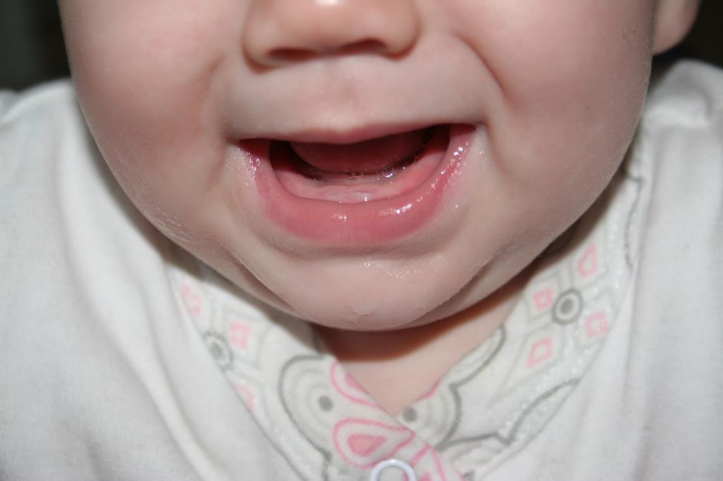 Реакция у детей на прорезывание зубов Как понять что у
