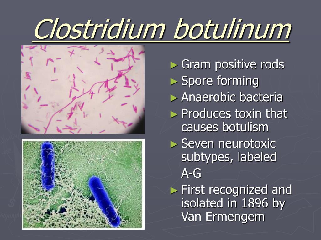 Кластридии. Клостридиум ботулинум. Clostridium botulinum споры. Clostridium botulinum микроскоп. Клостридии ботулизма ( Clostridium botulinum ) ботулизм.