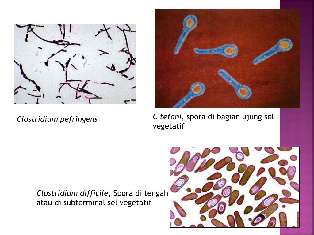 Клостридиум диффициле. Клостридии патогенные и непатогенные.