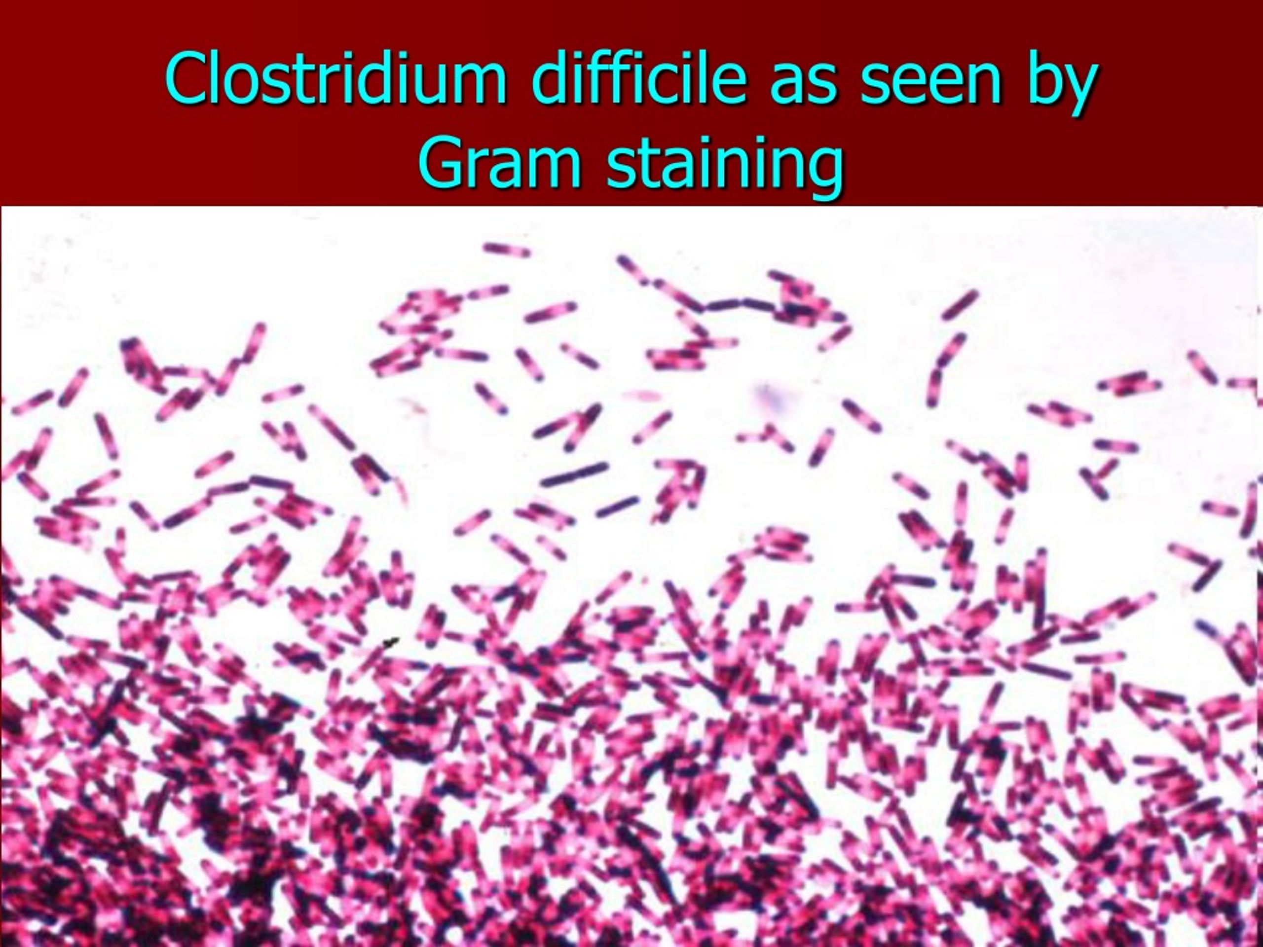 Клостридиум диффициле. Клостридии (Clostridia). Clostridium difficile микробиология. Клостридии грамположительные.