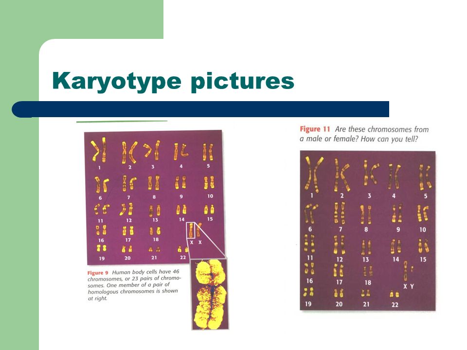 Karyotype pictures