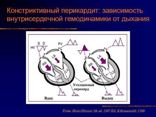 Инфографика 1